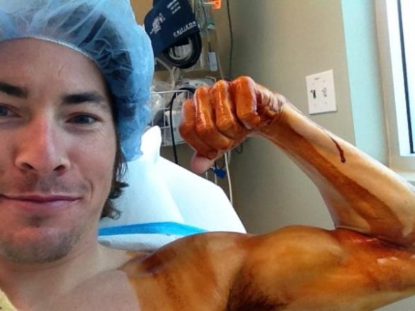 Nicky Hayden vor der Schulter OP